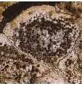 Lichen Caloplaca Flavescens Lichen Caloplaca Flavescens